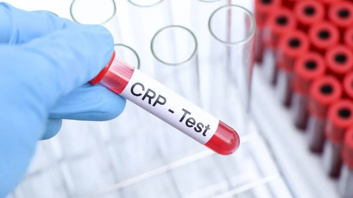 The hs-CRP Test: How to Get It, What It Costs, and How to Read Your Results