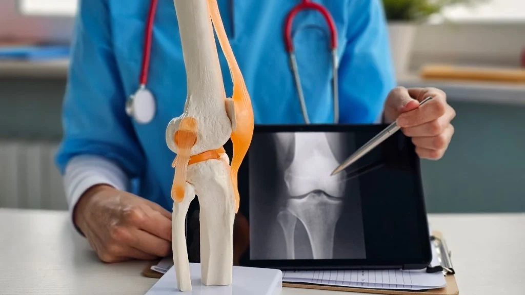 The Delayed Balloon Effect (Post Activity Effusion)