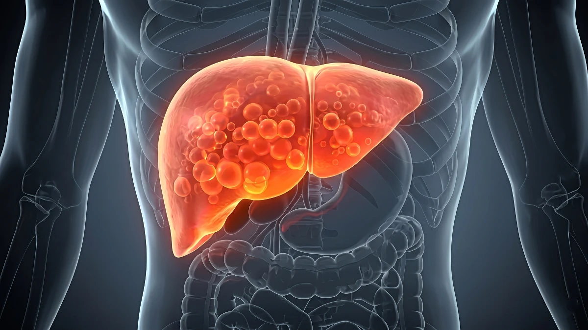 15 Foods Your Liver Is BEGGING You To Stop Eating (Hepatologists Sound The Alarm)