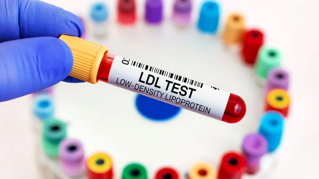 Lipoprotein(a) blood test