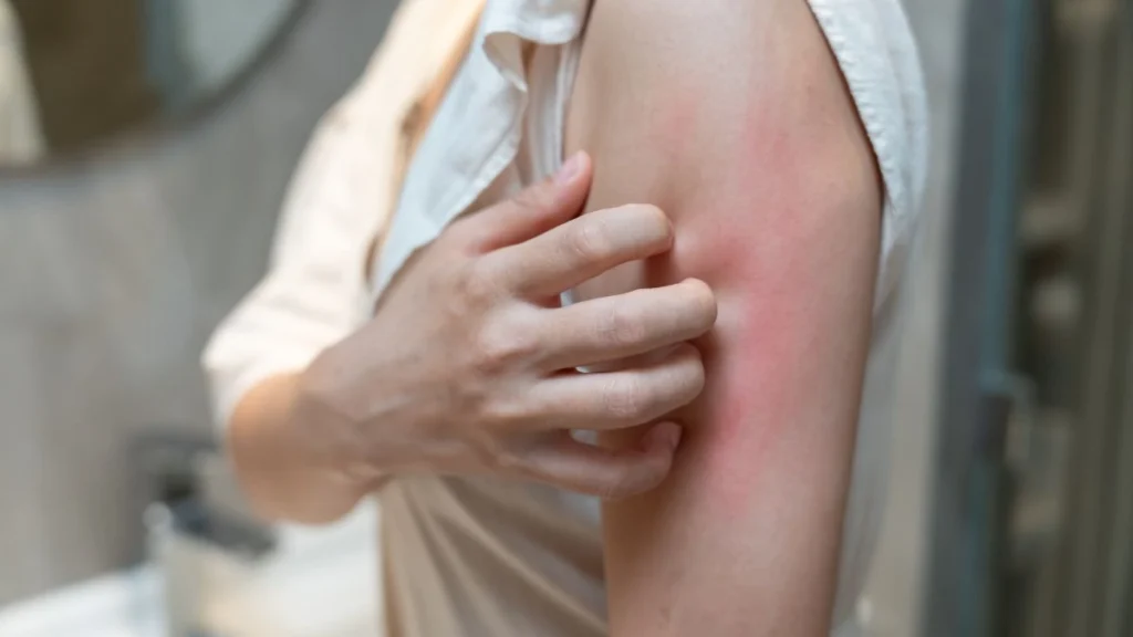 Dry and Deeply Itchy Skin