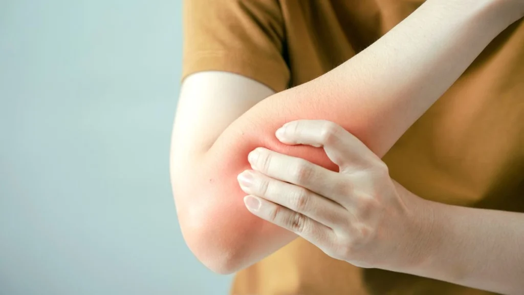 Stubborn Joint Pain and Muscle Stiffness