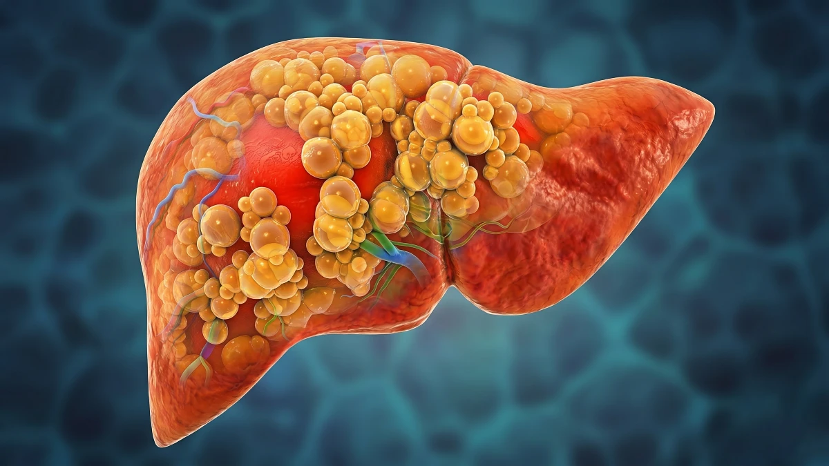 11 Silent Signs Your Liver Is Begging for Help After 50 (Most People Miss #3)