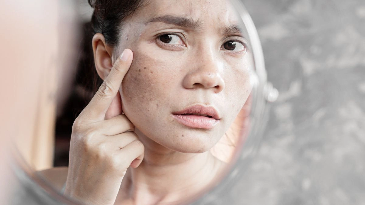 This Blood Sugar Warning Sign Appears on Your Skin 5 Years Before Diagnosis — Most Doctors Don't Mention It