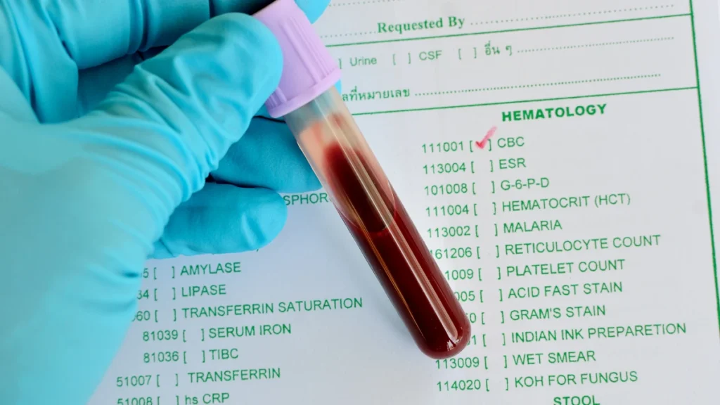 The Final Word on Your Bloodwork