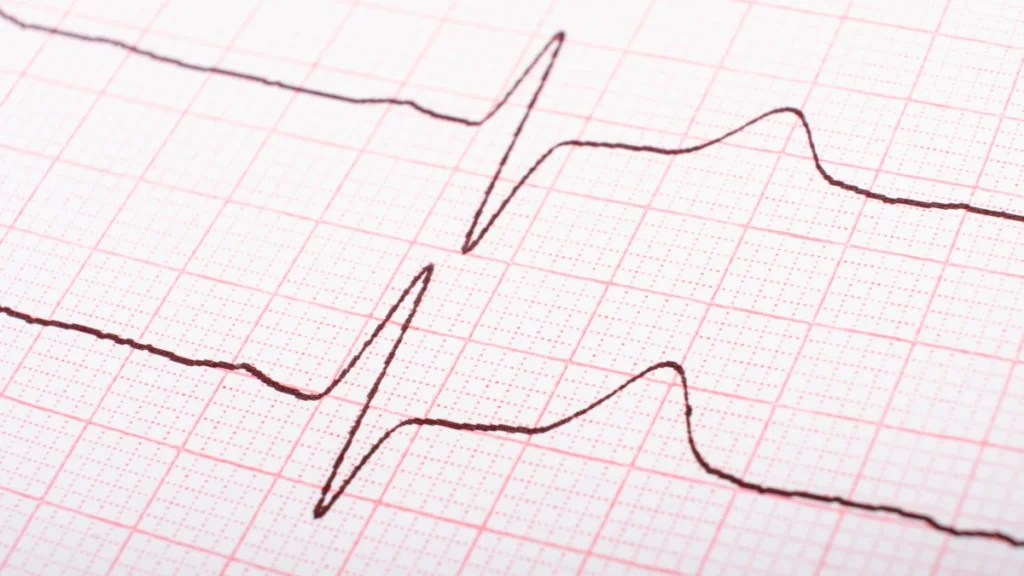 Why Heart Rate Variability Is Your Second Warning Sign