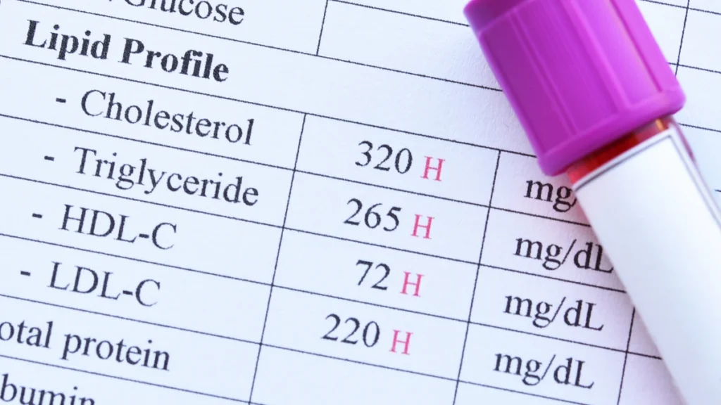 Why Is Your Diet Failing? The Lipid Turnover Trap