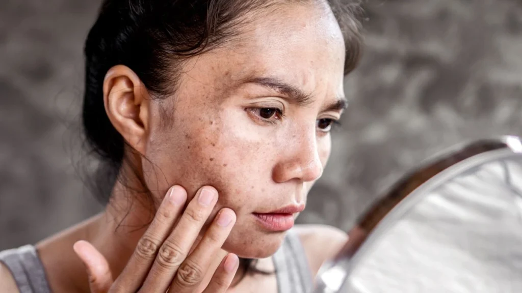 Sunscreen Mistakes Making Your Dark Spots Worse