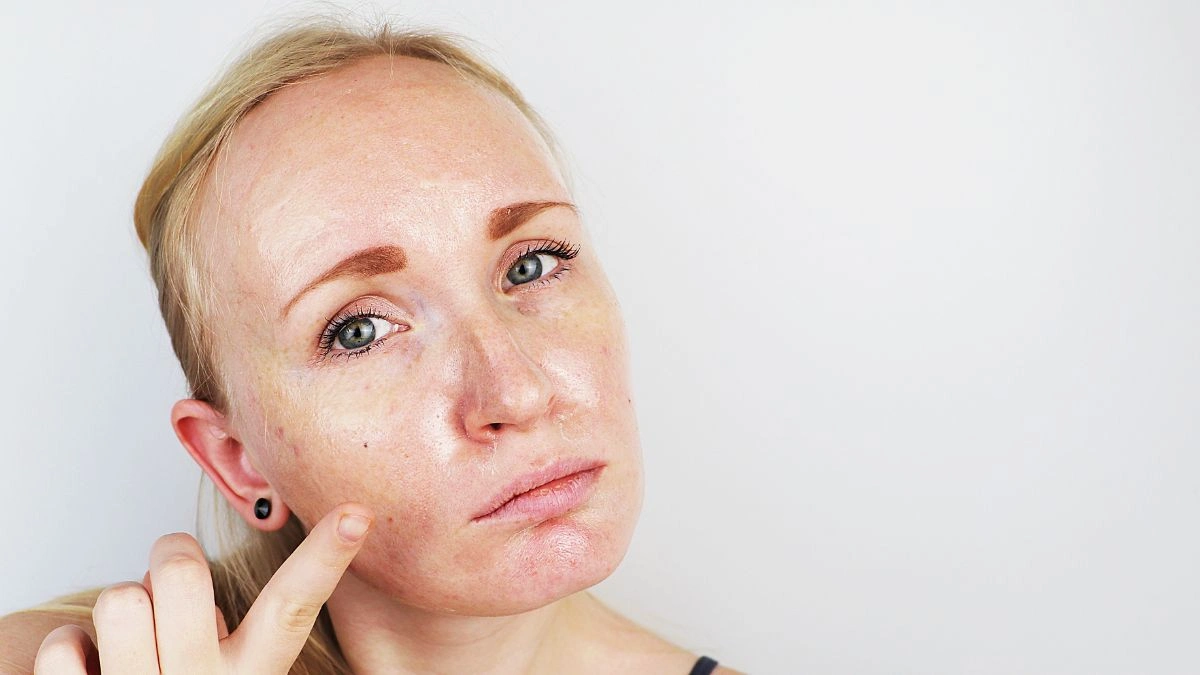 Sunscreen was only tested on one skin type for decades. Here's what that means for everyone else