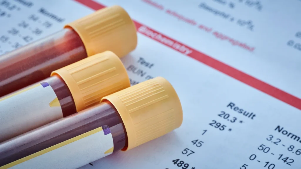 Why Standard Liver and Blood Tests Miss the Danger