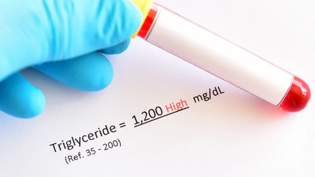 The Backup Plan: How to Check Your Triglyceride to HDL Ratio