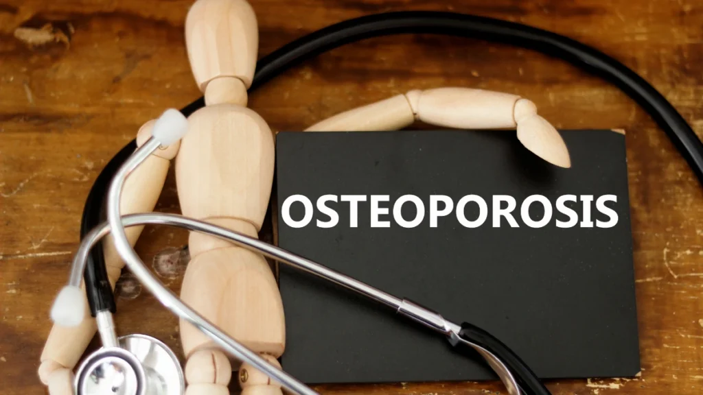 Osteoporosis Medications