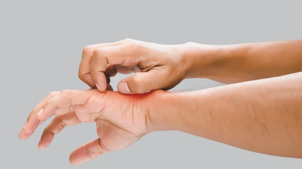 Extreme Unquenchable Itching