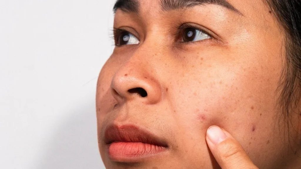 Painful Hard Lumps Under the Skin